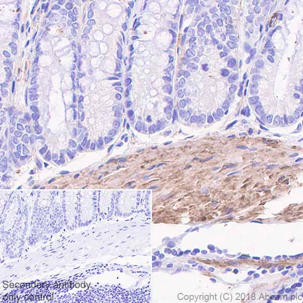 Immunohistochemistry (Formalin/PFA-fixed paraffin-embedded sections) - Anti-Caldesmon/CDM antibody [SP226] - BSA and Azide free (AB238782)
