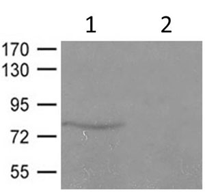 Western blot - Anti-Caldesmon/CDM (phospho S789) antibody (AB182653), expandable thumbnail
