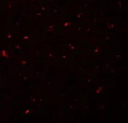 Immunocytochemistry/ Immunofluorescence - Anti-CALHM1 antibody (AB106561)