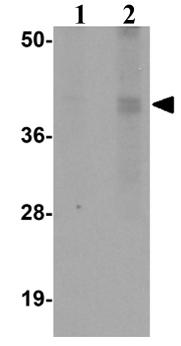 Western blot - Anti-CALHM1 antibody (AB106561), expandable thumbnail