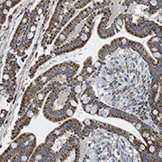 Immunohistochemistry (Formalin/PFA-fixed paraffin-embedded sections) - Anti-CALHM2 antibody (AB121446), expandable thumbnail