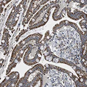 Immunohistochemistry (Formalin/PFA-fixed paraffin-embedded sections) - Anti-CALHM2 antibody (AB121446)