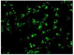 Immunocytochemistry/ Immunofluorescence - Anti-Calmegin antibody [EPR11832-11] (AB172477), expandable thumbnail