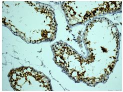 Immunohistochemistry (Formalin/PFA-fixed paraffin-embedded sections) - Anti-Calmegin antibody [EPR11832-11] (AB172477), expandable thumbnail