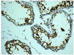 Immunohistochemistry (Formalin/PFA-fixed paraffin-embedded sections) - Anti-Calmegin antibody [EPR11832-11] (AB172477)