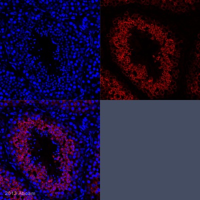 Immunohistochemistry (Formalin/PFA-fixed paraffin-embedded sections) - Anti-Calmegin antibody [EPR11832-11] (AB172477), expandable thumbnail