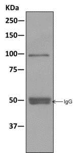 Immunoprecipitation - Anti-Calmegin antibody [EPR11832-11] (AB172477), expandable thumbnail