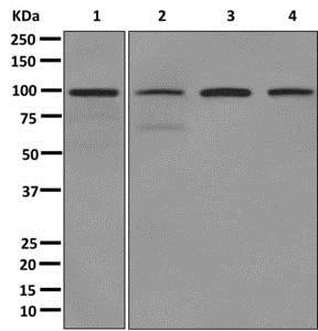 Western blot - Anti-Calmegin antibody [EPR11832-11] (AB172477), expandable thumbnail