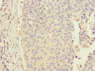 Immunohistochemistry (Formalin/PFA-fixed paraffin-embedded sections) - Anti-CALML3 antibody (AB230240)