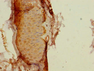 Immunohistochemistry (Formalin/PFA-fixed paraffin-embedded sections) - Anti-CALML3 antibody (AB230240)