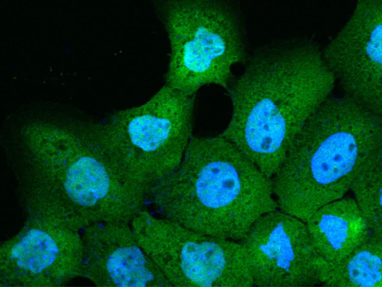 Immunocytochemistry - Anti-CALML5 antibody [158] - BSA and Azide free (AB276058)