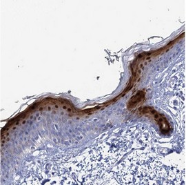 Immunohistochemistry (Formalin/PFA-fixed paraffin-embedded sections) - Anti-CALML5 antibody (AB122665), expandable thumbnail