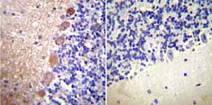 Immunohistochemistry (Formalin/PFA-fixed paraffin-embedded sections) - Anti-Calmodulin 1/2/3 antibody [2D1] (AB2860)