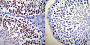 Immunohistochemistry (Formalin/PFA-fixed paraffin-embedded sections) - Anti-Calmodulin 1/2/3 antibody [2D1] (AB2860)