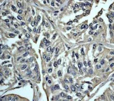 Immunohistochemistry (Formalin/PFA-fixed paraffin-embedded sections) - Anti-Calmodulin 1/2/3 antibody [EP799Y] - C-terminal (AB45689)
