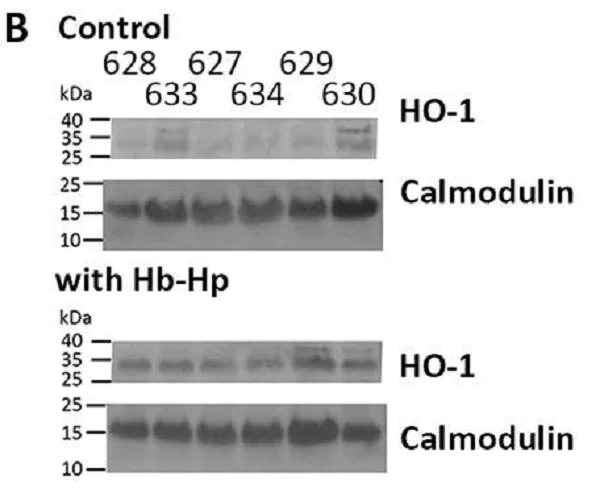 Western blot - Anti-Calmodulin 1/2/3 antibody [EP799Y] - C-terminal (AB45689)