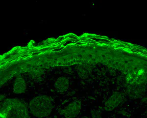 Immunohistochemistry (Formalin/PFA-fixed paraffin-embedded sections) - Anti-Calnexin antibody (AB13505)