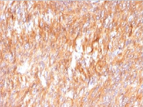 Immunohistochemistry (Formalin/PFA-fixed paraffin-embedded sections) - Anti-Calnexin antibody [CANX/1541] - BSA and Azide free (AB269752), expandable thumbnail