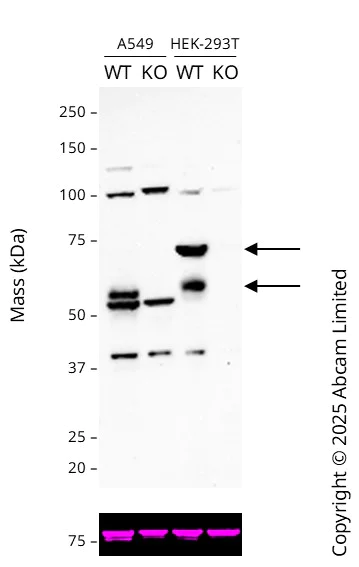 Western blot - Anti-Calnexin antibody [CANX/1543] (AB238078)