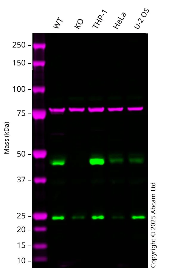 Western blot - Anti-Calnexin antibody [CANX/1543] (AB238078)