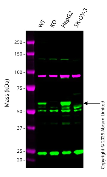 Western blot - Anti-Calnexin antibody [CANX/1543] (AB238078)