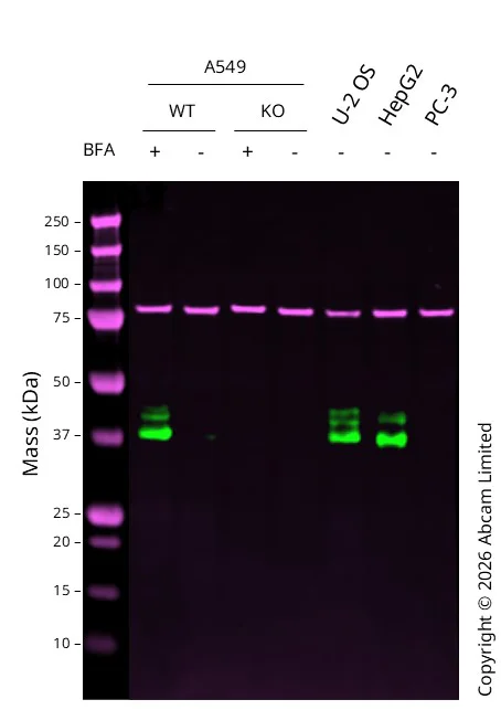Western blot - Anti-Calnexin antibody [CANX/1543] (AB238078)