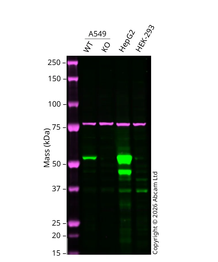 Western blot - Anti-Calnexin antibody [CANX/1543] (AB238078)