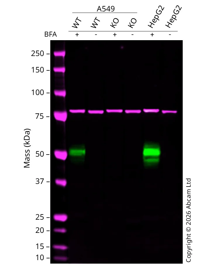 Western blot - Anti-Calnexin antibody [CANX/1543] (AB238078)