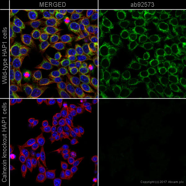 Anti-Calnexin 抗体 [EPR3632] (ab92573) | Abcam
