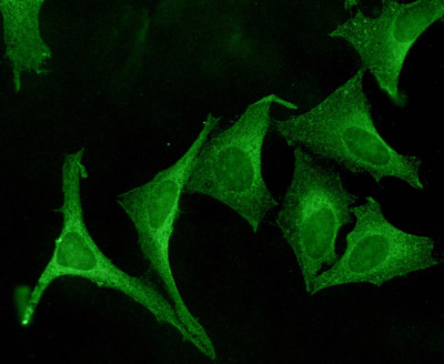 Immunocytochemistry/ Immunofluorescence - Anti-Calnexin antibody - ER Membrane Marker (AB75801)
