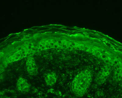 Immunohistochemistry (Formalin/PFA-fixed paraffin-embedded sections) - Anti-Calnexin antibody - ER Membrane Marker (AB75801)