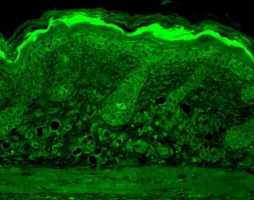Immunohistochemistry (Formalin/PFA-fixed paraffin-embedded sections) - Anti-Calnexin - ER membrane marker antibody - ER Marker (AB13504)