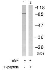 Western blot - Anti-Calnexin (phospho S583) antibody (AB58503)