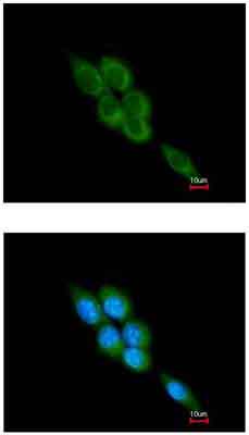 Immunocytochemistry/ Immunofluorescence - Anti-Calpain 1 antibody (AB155677)