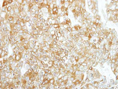 Immunohistochemistry (Formalin/PFA-fixed paraffin-embedded sections) - Anti-Calpain 1 antibody (AB155677)