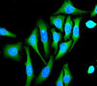 Immunocytochemistry/ Immunofluorescence - Anti-Calpain 1 antibody [EPR3319] - BSA and Azide free (AB239930)
