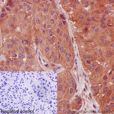 Immunohistochemistry (Formalin/PFA-fixed paraffin-embedded sections) - Anti-Calpain 1 antibody [EPR3319] - BSA and Azide free (AB239930)
