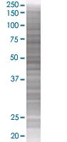 SDS-PAGE - Calpain 1 overexpression 293T lysate (whole cell) (AB94240)