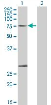 Western blot - Calpain 1 overexpression 293T lysate (whole cell) (AB94240)