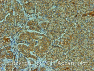 Immunohistochemistry (Formalin/PFA-fixed paraffin-embedded sections) - Anti-Calpain 10 antibody (AB28226)