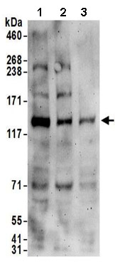 Western blot - Anti-Calpain 15/SOLH antibody (AB174649)