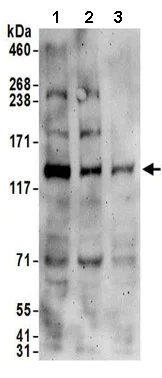 Western blot - Anti-Calpain 15/SOLH antibody (AB174649)