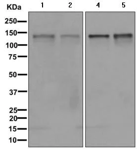 Western blot - Anti-Calpain 15/SOLH antibody [EPR11078] (AB170926)