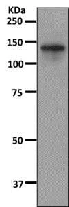 Western blot - Anti-Calpain 15/SOLH antibody [EPR11078] - BSA and Azide free (AB249597)