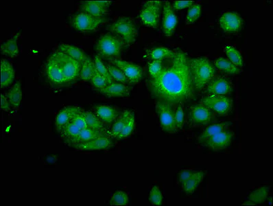 Immunocytochemistry/ Immunofluorescence - Anti-Calpain 2 antibody (AB236650)