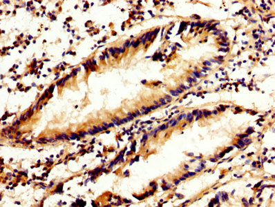 Immunohistochemistry (Formalin/PFA-fixed paraffin-embedded sections) - Anti-Calpain 2 antibody (AB236650)