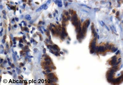 Immunohistochemistry (Formalin/PFA-fixed paraffin-embedded sections) - Anti-Calpain 2 antibody (AB39165)