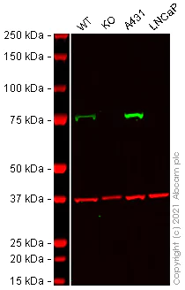 Western blot - Anti-Calpain 2 antibody [EPR2562Y] (AB75994)