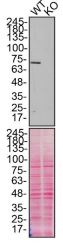 Western blot - Anti-Calpain 2 antibody [EPR2562Y] (AB75994), expandable thumbnail