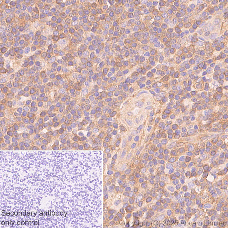 Immunohistochemistry (Formalin/PFA-fixed paraffin-embedded sections) - Anti-Calpain 2 antibody [EPR29833-94] (AB325140)